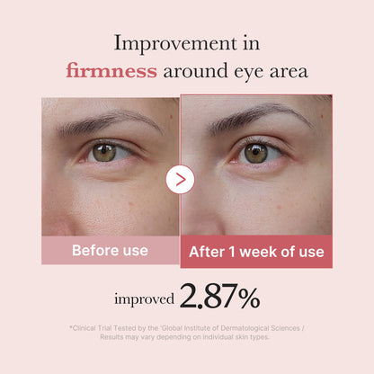 [Subscr.] PDRN Pink Peptide Eye Cream